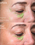 Maydi+ Renewal Day Cream. Before and after comparison of a woman's face with skincare treatment effects, showing fine lines and deep wrinkles improvement after 8 weeks.