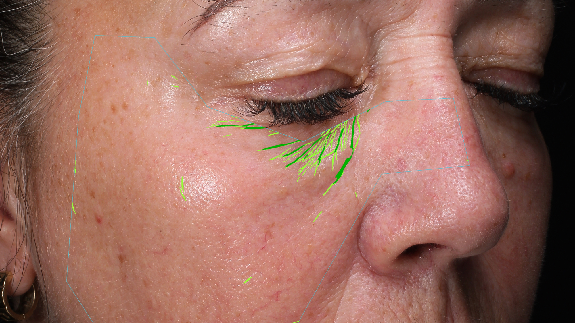 Eye Cream vs Face Cream: Why the Eye Area Needs Precision Formulation