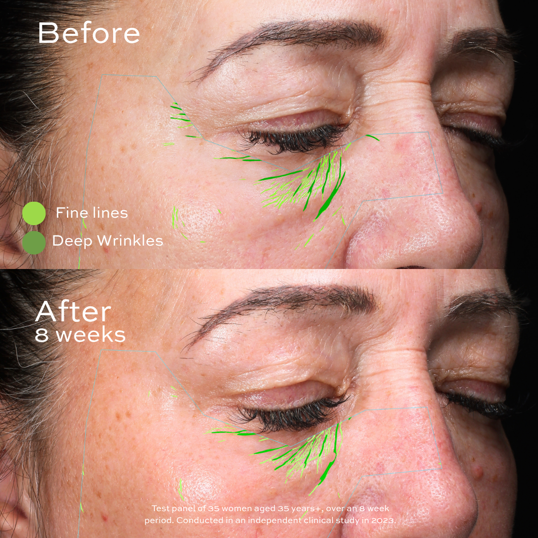 Maydi+ Renewal Day Cream. Before and after comparison of a woman's face with skincare treatment effects, showing fine lines and deep wrinkles improvement after 8 weeks.